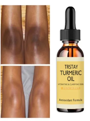 5ML/15ML/30ML/50ML/New Turmeric Oil Glow To Facial Lightening Serum For Black Brown Skin Leg Hand Body Whitening For Dark Skin Beauty Health